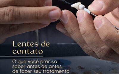 Lentes de contato dental: o que você precisa saber antes de usá-las