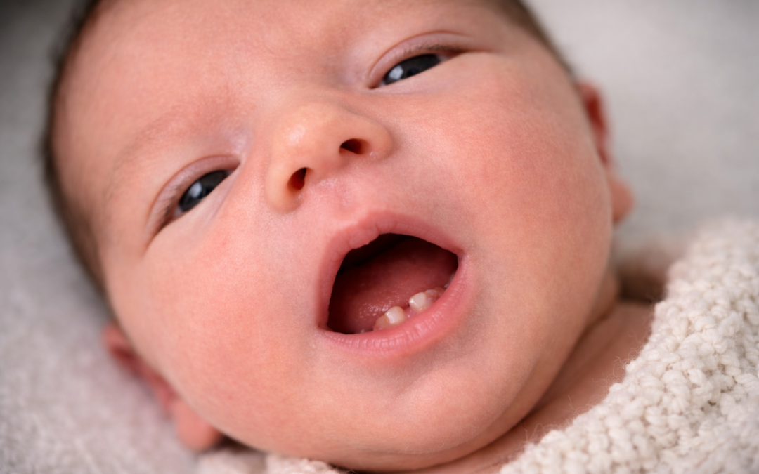 Bebê nascer com dente é normal? Entenda as causas